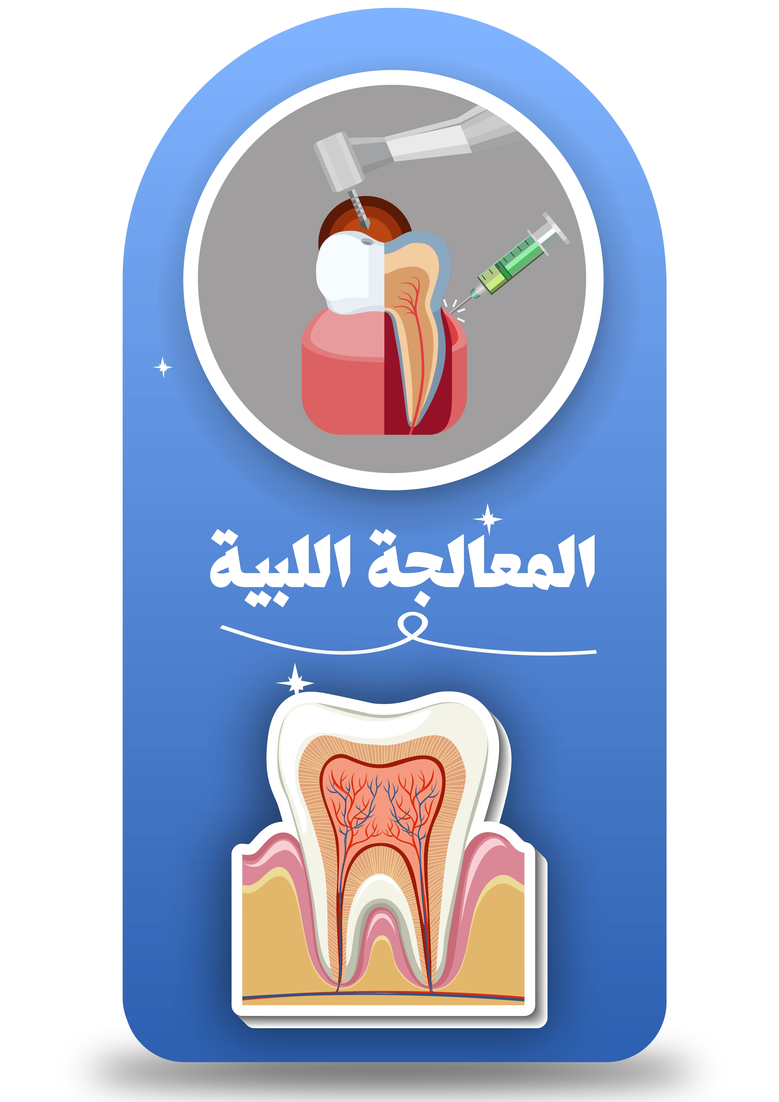 root canal treatment