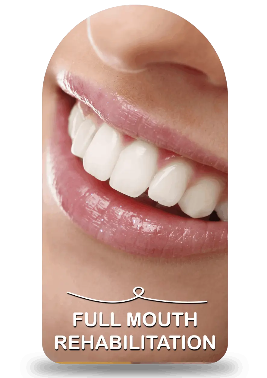 Mouth Rehabilitation 